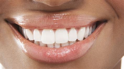 Brighten Your Smile Naturally: Experience the Magic of Magic White Teeth Whitening